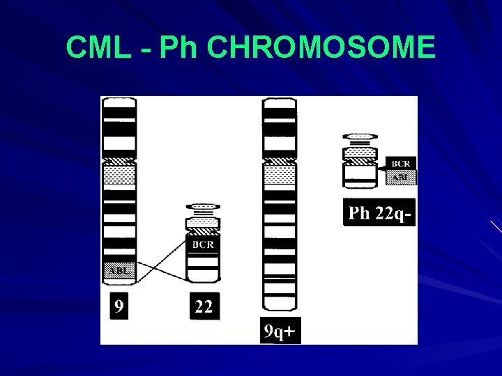 CML - Ph CHROMOSOME 