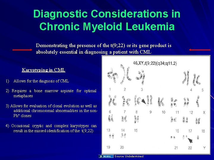Diagnostic Considerations in Chronic Myeloid Leukemia Demonstrating the presence of the t(9; 22) or