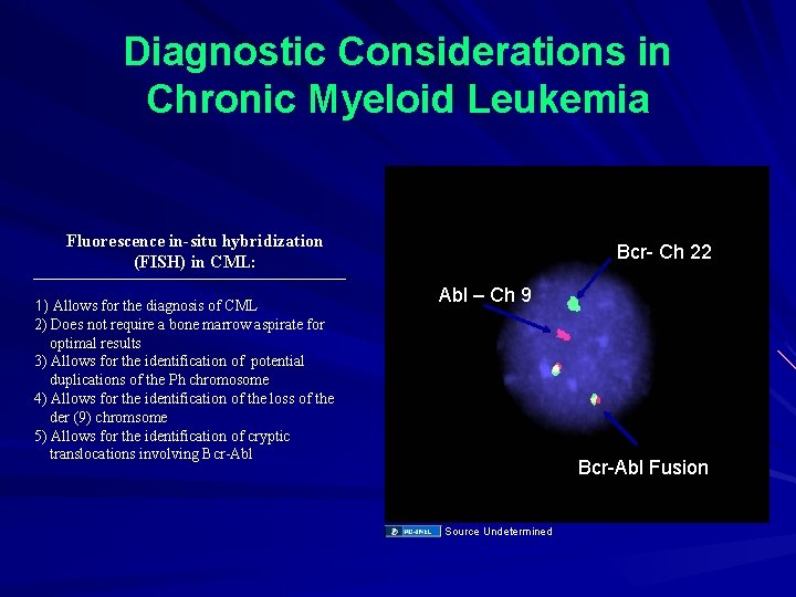 Diagnostic Considerations in Chronic Myeloid Leukemia Fluorescence in-situ hybridization (FISH) in CML: 1) Allows