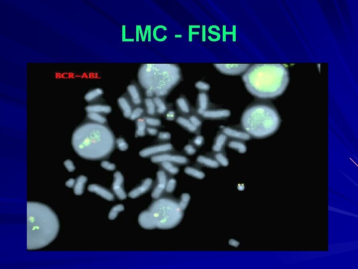 LMC - FISH 