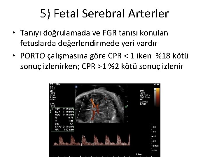 5) Fetal Serebral Arterler • Tanıyı doğrulamada ve FGR tanısı konulan fetuslarda değerlendirmede yeri