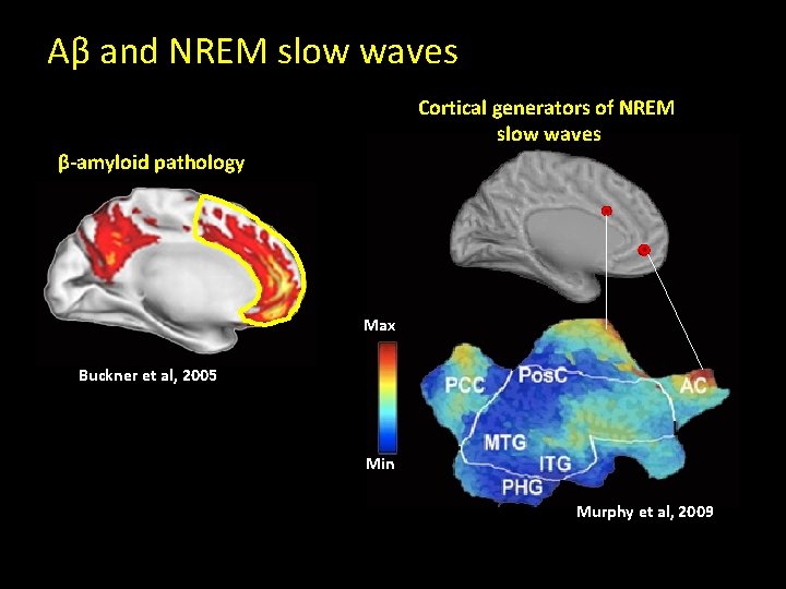 Aβ and NREM slow waves Cortical generators of NREM slow waves β-amyloid pathology Max