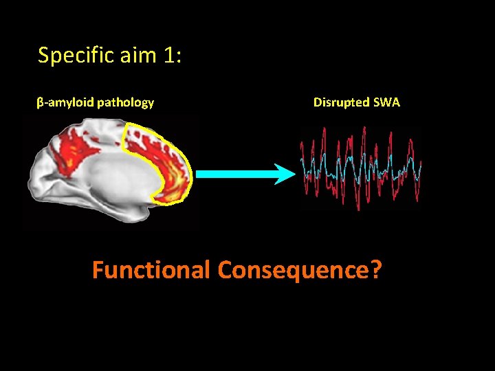 Specific aim 1: β-amyloid pathology Disrupted SWA Functional Consequence? 