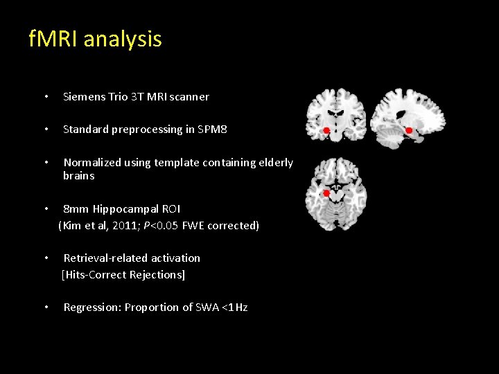 f. MRI analysis • Siemens Trio 3 T MRI scanner • Standard preprocessing in