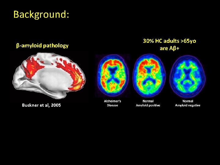 Background: β-amyloid pathology Buckner et al, 2005 30% HC adults >65 yo are Aβ+