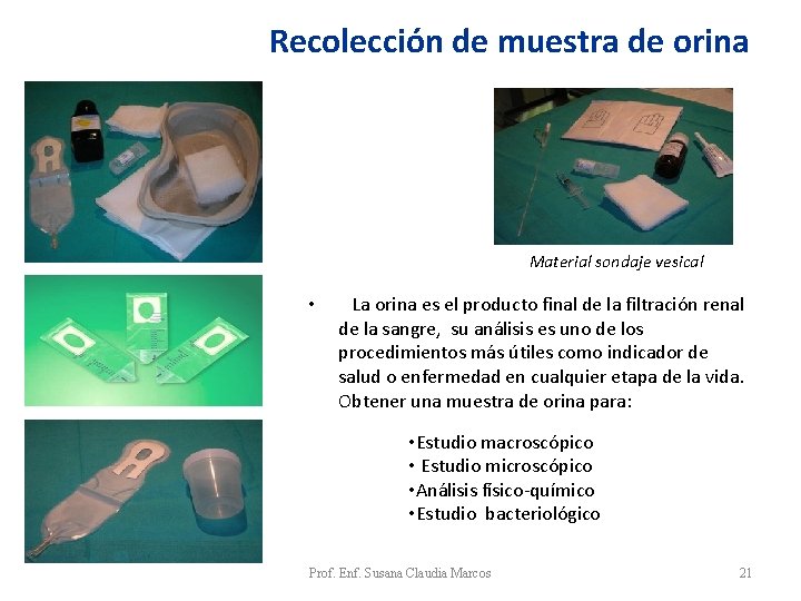 Recolección de muestra de orina Material sondaje vesical La orina es el producto final Recolección de muestra de orina Material sondaje vesical La orina es el producto final