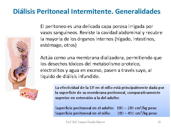 Diálisis Peritoneal Intermitente. Generalidades El peritoneo es una delicada capa porosa irrigada por vasos Diálisis Peritoneal Intermitente. Generalidades El peritoneo es una delicada capa porosa irrigada por vasos
