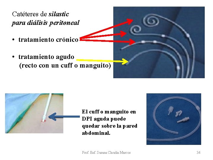 Catéteres de silastic para diálisis peritoneal • tratamiento crónico • tratamiento agudo (recto con Catéteres de silastic para diálisis peritoneal • tratamiento crónico • tratamiento agudo (recto con