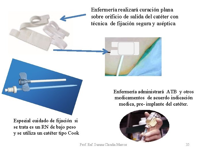 Enfermería realizará curación plana sobre orificio de salida del catéter con técnica de fijación Enfermería realizará curación plana sobre orificio de salida del catéter con técnica de fijación