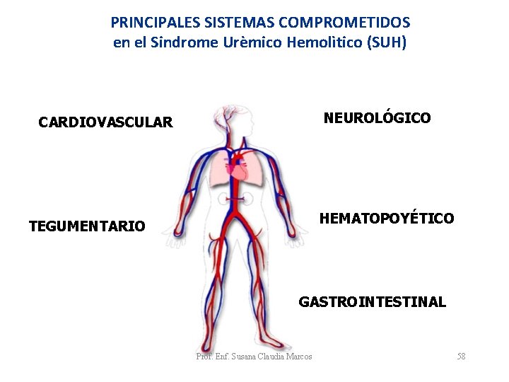 PRINCIPALES SISTEMAS COMPROMETIDOS en el Sindrome Urèmico Hemolìtico (SUH) NEUROLÓGICO CARDIOVASCULAR HEMATOPOYÉTICO TEGUMENTARIO GASTROINTESTINAL PRINCIPALES SISTEMAS COMPROMETIDOS en el Sindrome Urèmico Hemolìtico (SUH) NEUROLÓGICO CARDIOVASCULAR HEMATOPOYÉTICO TEGUMENTARIO GASTROINTESTINAL