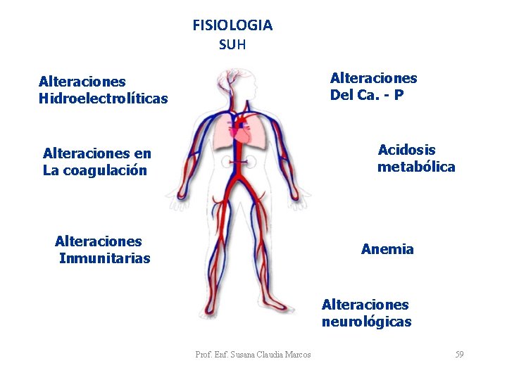 FISIOLOGIA SUH Alteraciones Del Ca. - P Alteraciones Hidroelectrolíticas Acidosis metabólica Alteraciones en La FISIOLOGIA SUH Alteraciones Del Ca. - P Alteraciones Hidroelectrolíticas Acidosis metabólica Alteraciones en La