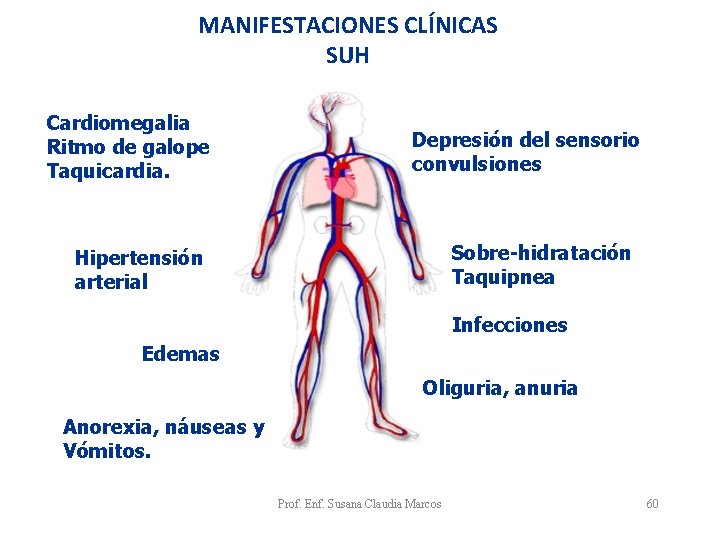 MANIFESTACIONES CLÍNICAS SUH Cardiomegalia Ritmo de galope Taquicardia. Depresión del sensorio convulsiones Sobre-hidratación Taquipnea MANIFESTACIONES CLÍNICAS SUH Cardiomegalia Ritmo de galope Taquicardia. Depresión del sensorio convulsiones Sobre-hidratación Taquipnea