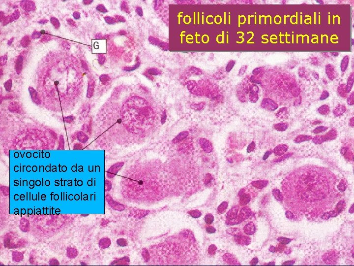 follicoli primordiali in feto di 32 settimane ovocito circondato da un singolo strato di follicoli primordiali in feto di 32 settimane ovocito circondato da un singolo strato di