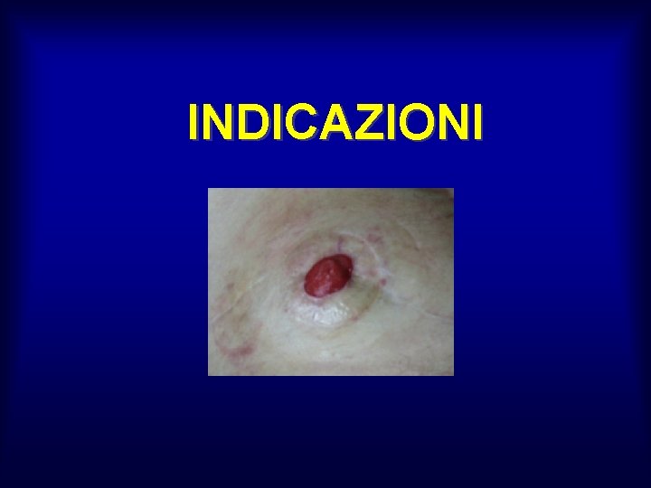 INDICAZIONI 