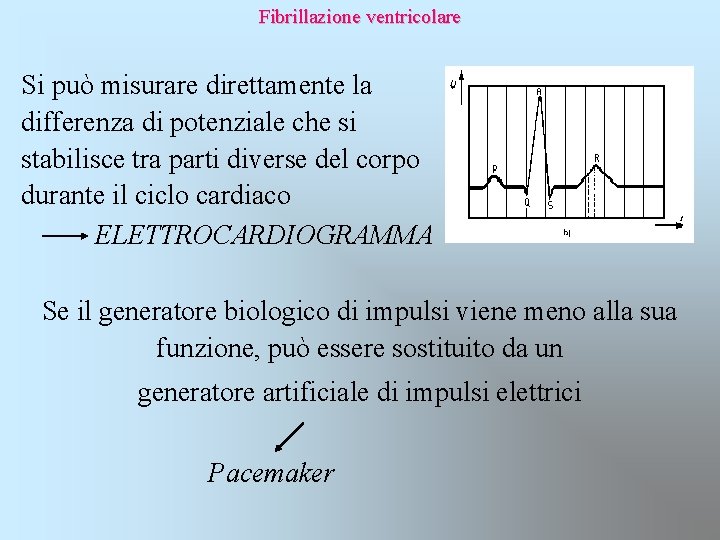 Fibrillazione ventricolare Si può misurare direttamente la differenza di potenziale che si stabilisce tra