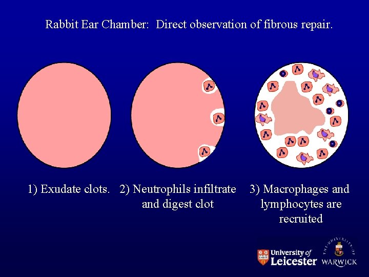 Rabbit Ear Chamber: Direct observation of fibrous repair. 1) Exudate clots. 2) Neutrophils infiltrate