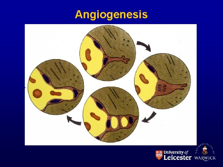 Angiogenesis 