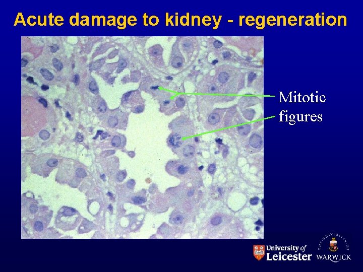 Acute damage to kidney - regeneration Mitotic figures 