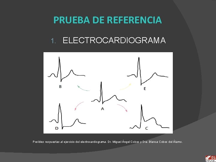 PRUEBA DE REFERENCIA 1. ELECTROCARDIOGRAMA Posibles respuestas al ejercicio del electrocardiograma. Dr. Miguel Ángel