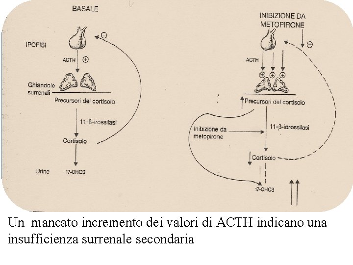 Un mancato incremento dei valori di ACTH indicano una insufficienza surrenale secondaria 