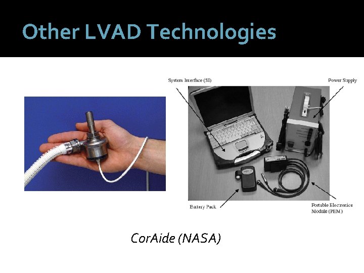 Other LVAD Technologies Cor. Aide (NASA) 