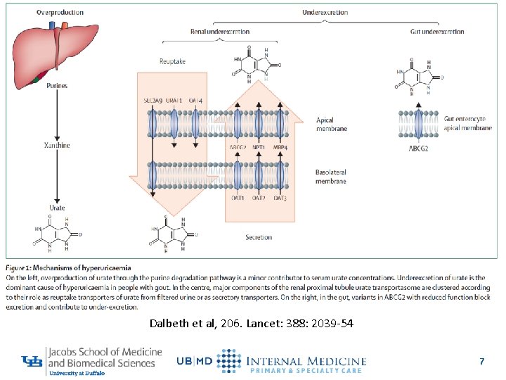 Dalbeth et al, 206. Lancet: 388: 2039 -54 7 