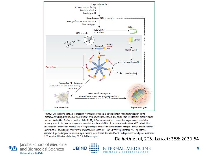 Dalbeth et al, 206. Lancet: 388: 2039 -54 9 