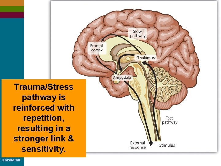 Trauma/Stress pathway is reinforced with repetition, resulting in a stronger link & sensitivity. ©ncdvtmh