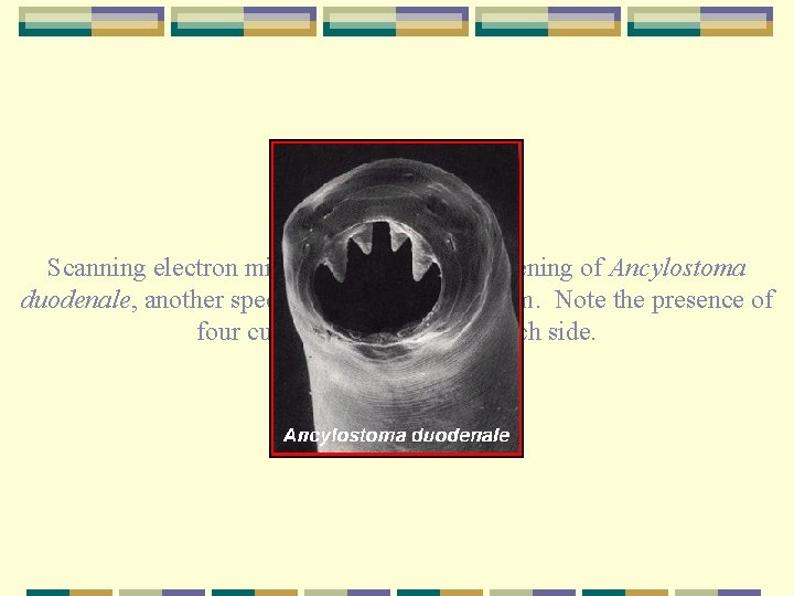 Scanning electron micrograph of the oral opening of Ancylostoma duodenale, another species of human