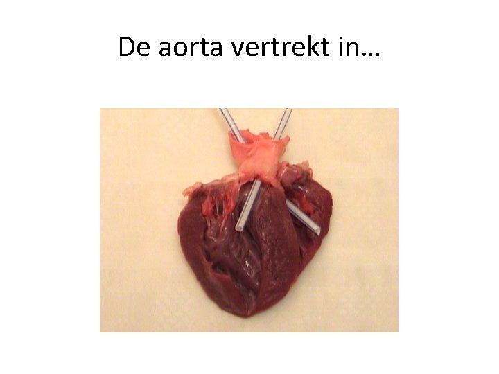 De aorta vertrekt in… 