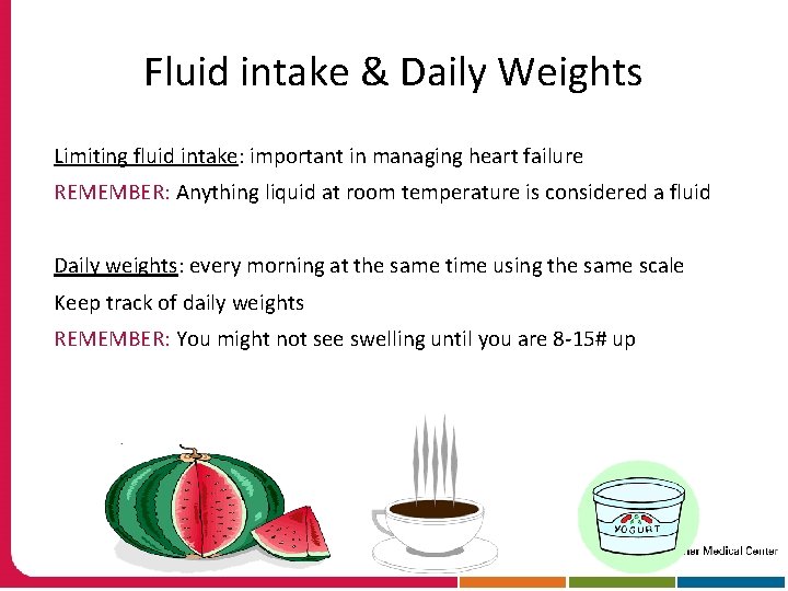 Fluid intake & Daily Weights Limiting fluid intake: important in managing heart failure REMEMBER: