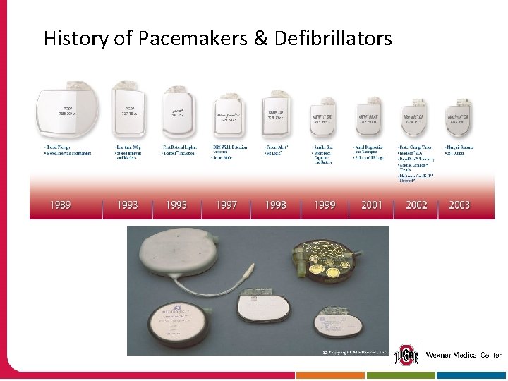 History of Pacemakers & Defibrillators 