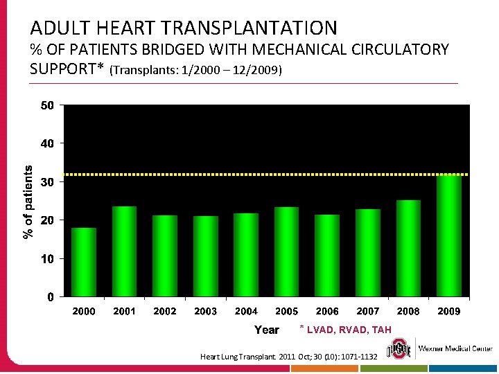 ADULT HEART TRANSPLANTATION % OF PATIENTS BRIDGED WITH MECHANICAL CIRCULATORY SUPPORT* (Transplants: 1/2000 –