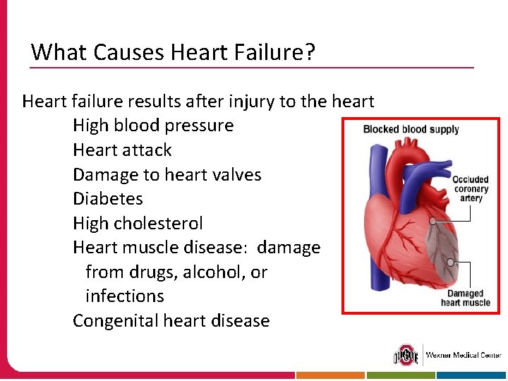 What Causes Heart Failure? Heart failure results after injury to the heart High blood