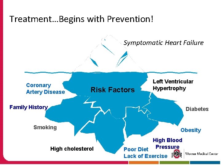 Treatment…Begins with Prevention! Symptomatic Heart Failure Coronary Artery Disease Risk Factors Left Ventricular Hypertrophy