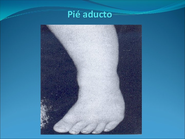 Pié aducto 