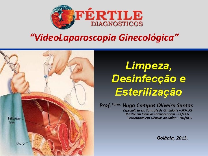 “Video. Laparoscopia Ginecológica” Limpeza, Desinfecção e Esterilização Prof. Farm. Hugo Campos Oliveira Santos Especialista