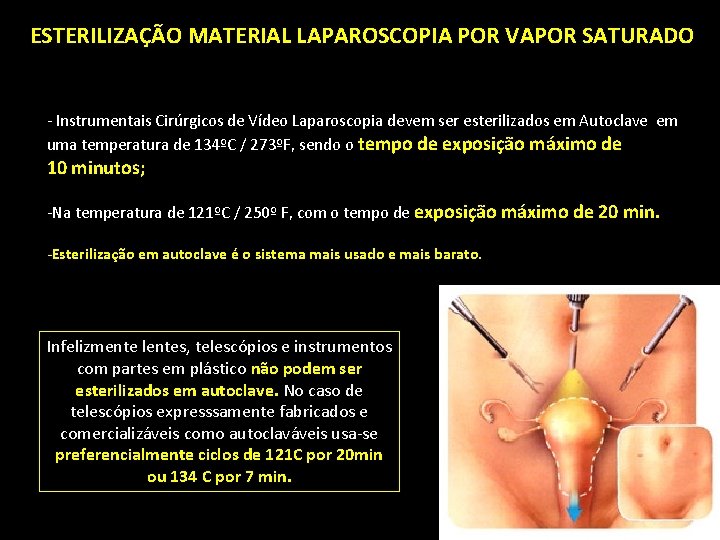 ESTERILIZAÇÃO MATERIAL LAPAROSCOPIA POR VAPOR SATURADO - Instrumentais Cirúrgicos de Vídeo Laparoscopia devem ser