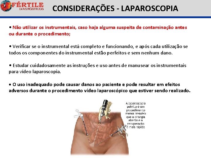  CONSIDERAÇÕES - LAPAROSCOPIA • Não utilizar os instrumentais, caso haja alguma suspeita de