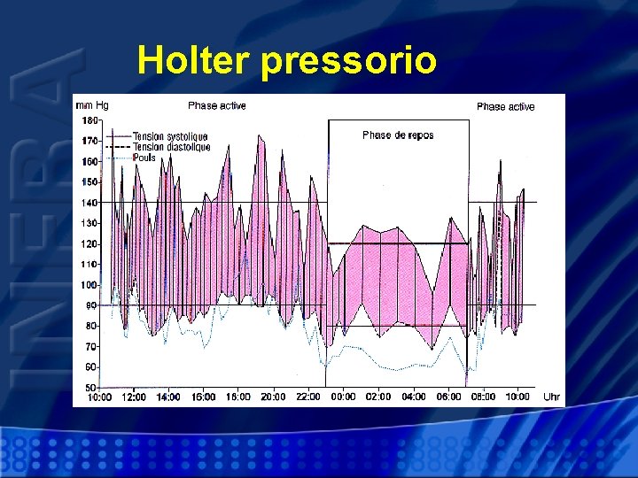 Holter pressorio 