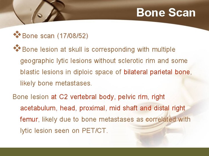 Bone Scan v. Bone scan (17/08/52) v. Bone lesion at skull is corresponding with