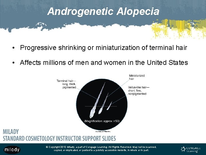 Androgenetic Alopecia • Progressive shrinking or miniaturization of terminal hair • Affects millions of