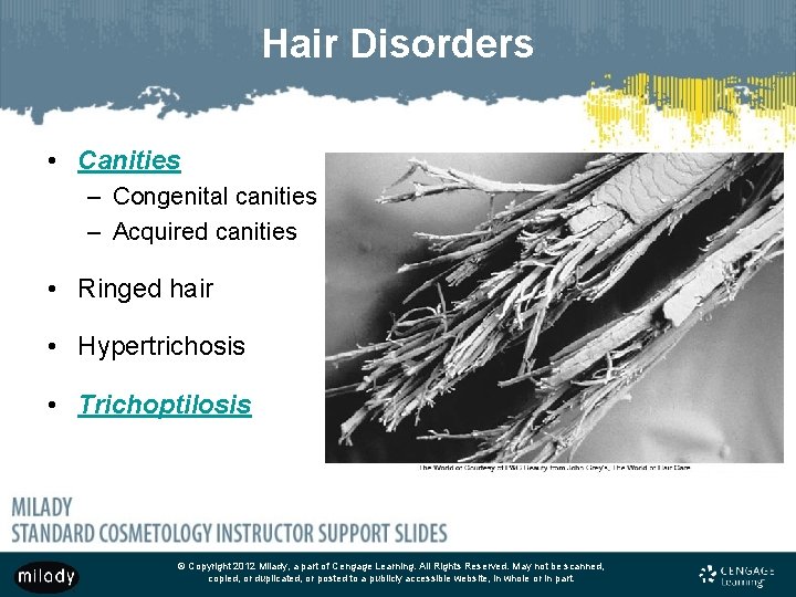 Hair Disorders • Canities – Congenital canities – Acquired canities • Ringed hair •