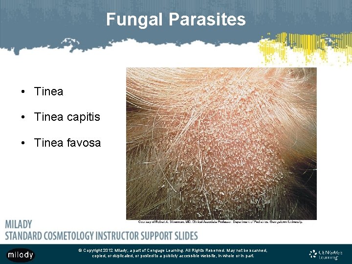 Fungal Parasites • Tinea capitis • Tinea favosa © Copyright 2012 Milady, a part