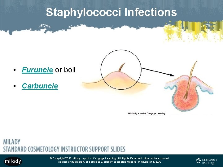 Staphylococci Infections • Furuncle or boil • Carbuncle © Copyright 2012 Milady, a part
