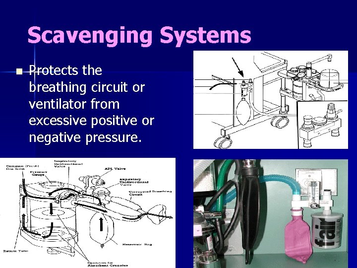 Scavenging Systems n Protects the breathing circuit or ventilator from excessive positive or negative