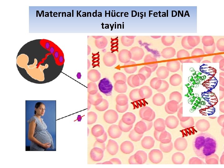 Maternal Kanda Hücre Dışı Fetal DNA tayini 