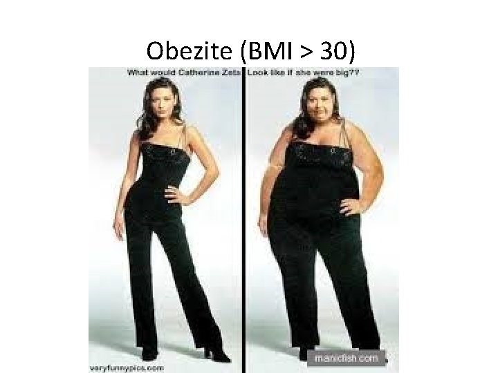 Obezite (BMI > 30) 33 