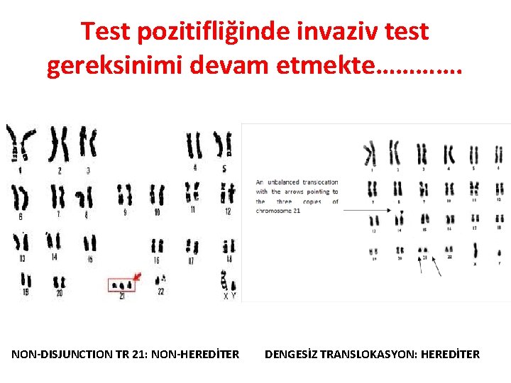 Test pozitifliğinde invaziv test gereksinimi devam etmekte…………. NON-DISJUNCTION TR 21: NON-HEREDİTER DENGESİZ TRANSLOKASYON: HEREDİTER