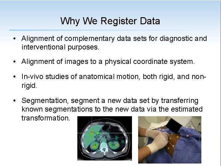Why We Register Data • Alignment of complementary data sets for diagnostic and interventional